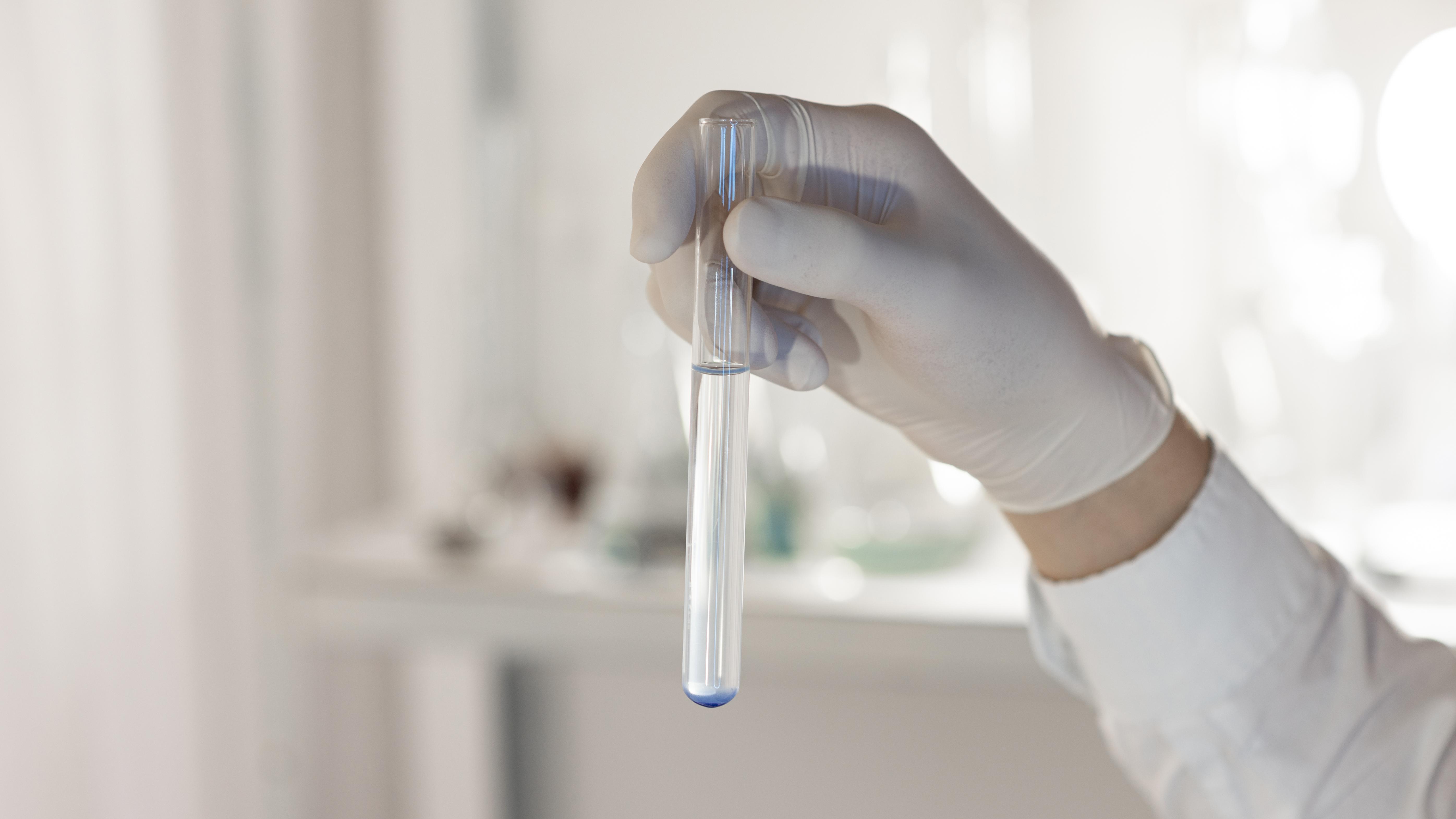 Saf Su Kalite Kontrol